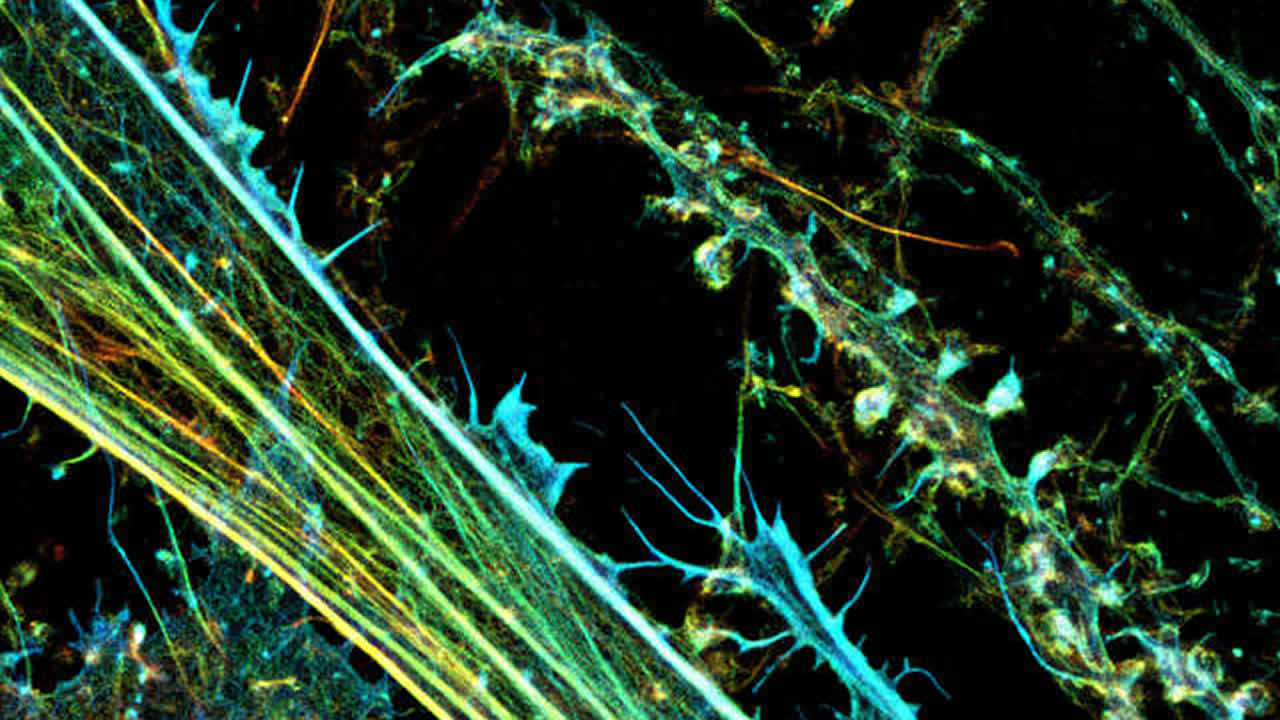 类器官和器官芯片成像产品