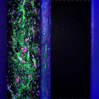 类器官和器官芯片成像